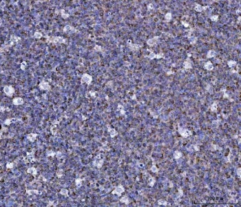 IHC staining of FFPE human tonsil tissue with MIP-5 antibody. HIER: boil tissue sections in pH8 EDTA