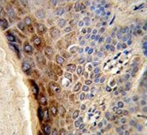 IHC testing of FFPE human skin tissue with CTHRC1 antibody. HIER: steam section in pH6 citrate buffe