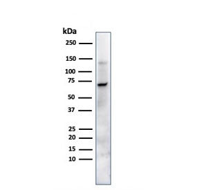 Western blot testing of human JEG-3 cells with Placental Alkaline Phosphatase antibody (clone ALP/87
