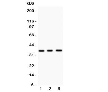 Nkx2-5 Antibody