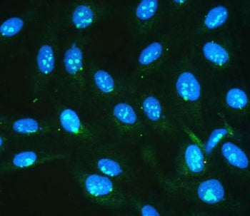 Immunofluorescent staining of FFPE human U-2 OS cells with IKKG antibody (green) and DAPI nuclear st