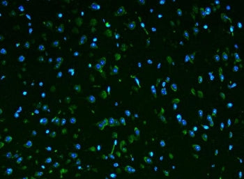 Rpl9 Antibody / 60S ribosomal protein L9