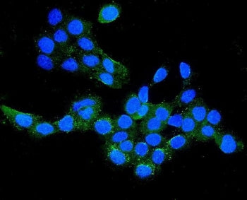 Claudin 16 Antibody / CLDN16