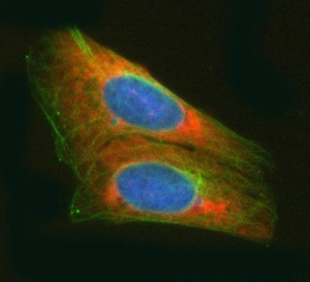 Immunofluorescent staining of FFPE human U-2 OS cells with ArgRS antibody (red), Alpha Tubulin mAb (
