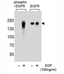 EGF Receptor Antibody (phospho-Y1172)