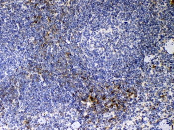 CD14 Antibody (Monocyte and Macrophage Marker)