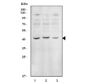 EIF2B Antibody (EIF2S2)