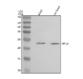 Western blot analysis of MYL4 using anti-MYL4 antibody. Lane 1: human K562 whole cell lysates, Lane