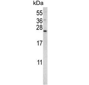 Sorting nexin-24 Antibody / SNX24