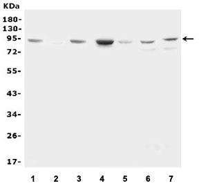 Factor VIII Antibody