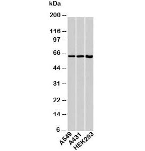 HSP60 Antibody / HSPD1