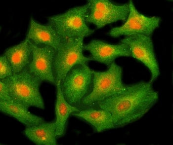 NHP2 Antibody / H/ACA ribonucleoprotein complex subunit 2