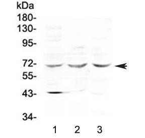 Western blot testing of human 1) COLO-320, 2) HepG2 and 3) 22RV1 cell lysate with SPHK2 antibody at
