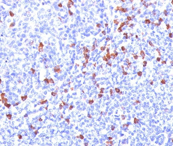 IHC: Formalin/paraffin human tonsil stained with Kappa Light Chain antibody (clone L1C1). Note cell
