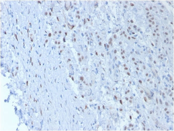 WT1 Antibody / Wilms Tumor 1