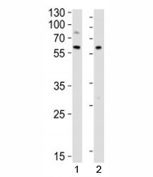 LYN Antibody