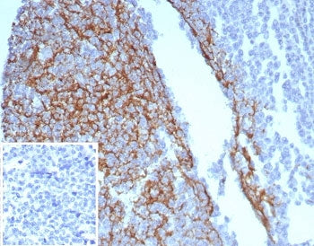 IHC staining of FFPE human tonsil tissue with CD23 antibody (clone FCER2/8234R). Inset: PBS used in