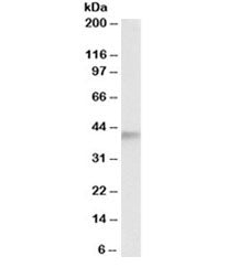 ADH5 Antibody