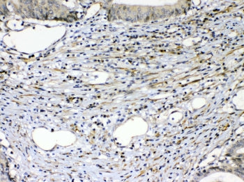 VEGF Receptor 2 Antibody / VEGFR2 / KDR