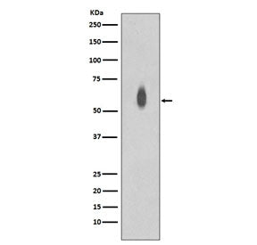 Phospho-c-Myc Antibody (pT58 + pS62)