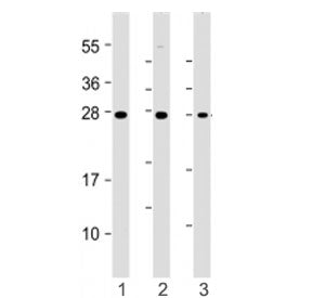 HAVCR2 Antibody / TIM-3