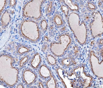 hDKIR Antibody / C3IP1 / KLHL12