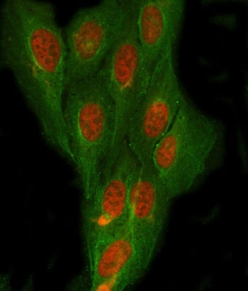 NDRG4 Antibody / N-myc downstream-regulated gene 4