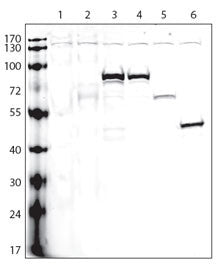 Lanes: 1: non-transfected cells; 2: V5-tagged empty plasmid; and V5-tagged proteins: 3-A, 4-B, 5-C,
