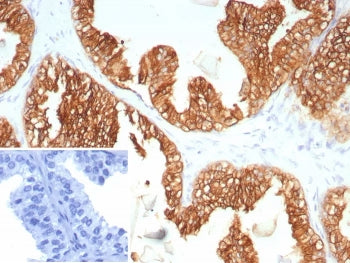 Cytokeratin 5/6 Antibody