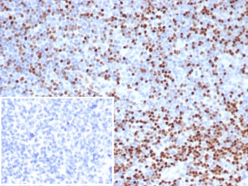 LEF1 Antibody / Lymphoid enhancer-binding factor 1 / TCF1 alpha