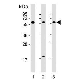 TGFB1 Antibody