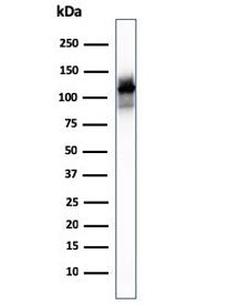 ACTN2 Antibody / Alpha Actinin 2 / Sarcomeric Alpha Actinin