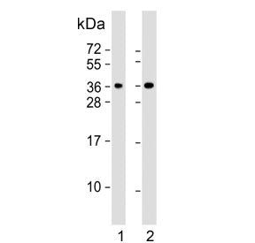 CLNS1A Antibody / pICln