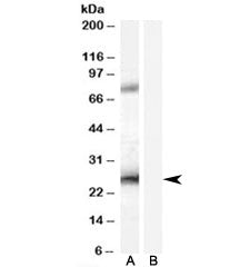EBAG9 Antibody