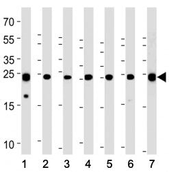 PGP9.5 Antibody (UCHL1)