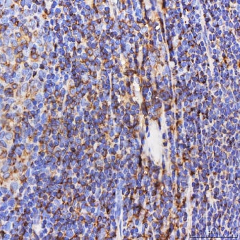 IHC staining of FFPE human tonsil tissue with Septin 6 antibody. HIER: boil tissue sections in pH8 E