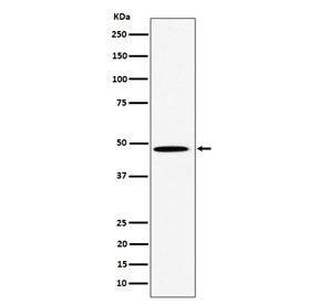 P4HTM Antibody / HIFPH4 / HIF Prolyl Hydroxylases
