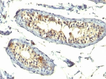 TGF alpha Antibody Cocktail