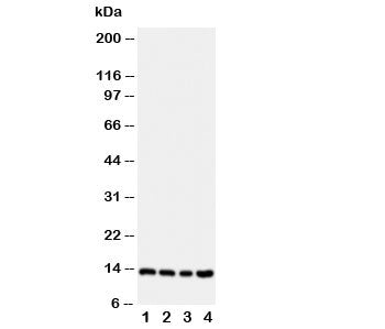 Western blot testing of Stefin B antibody; Lane 1: A549; 2: A431; 3: COLO320; 4: HeLa cell lysate. P