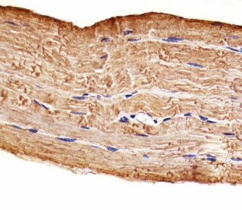 MAP4K3 Antibody / MEKKK3 / GLK