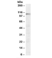 Western blot testing of HeLa lysate with SART1 antibody at 0.03ug/ml. Predicted molecular weight: ~9