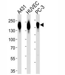 EGF Receptor Antibody