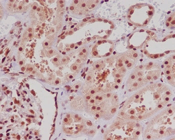 ERG Antibody / Transcriptional regulator ERG