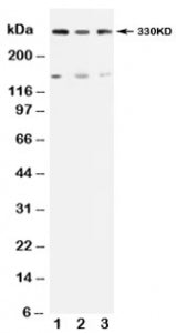 Western blot testing of ATM antibody and Lane 1: rat testis; 2: U87; 3: MCF-7