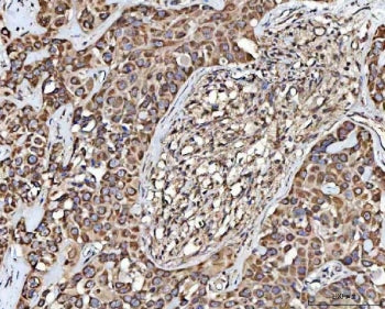MECR Antibody / 2-Enoyl thioester reductase