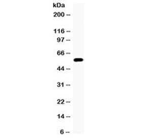 CYP17A1 Antibody