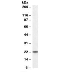 UBE2T Antibody