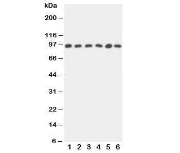 STAT5b Antibody