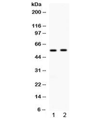Western blot testing of 1) rat liver and 2) human 22RV1 lysate with ALDH3A2 antibody at 0.5ug/ml. Pr