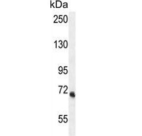 VPS52 Antibody / SACM2L